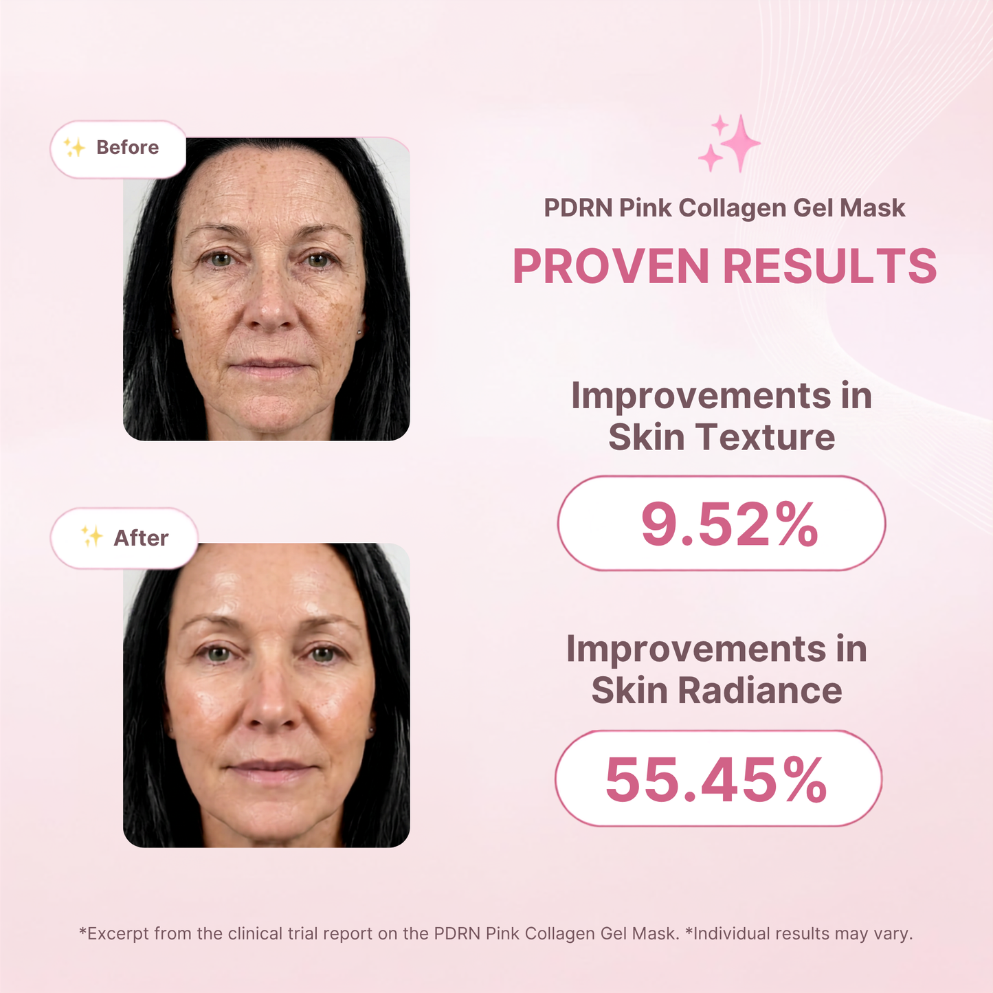 Salmon PDRN Collagen Mask